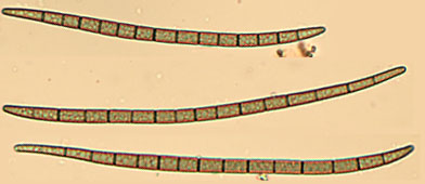 Trichoglossum hirsutum